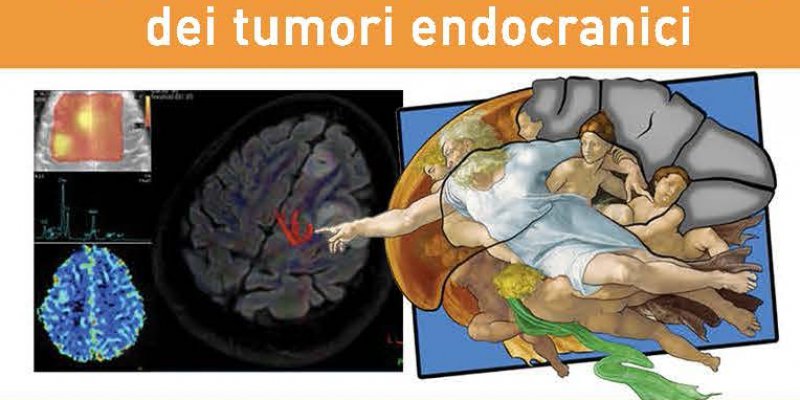 Diagnostica per Immagini dei TUMORI ENDOCRANICI